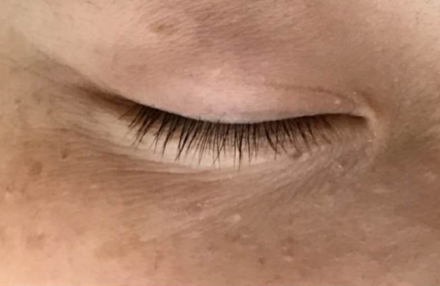 牙齿松动不掉了(牙齿松动不掉怎么办)